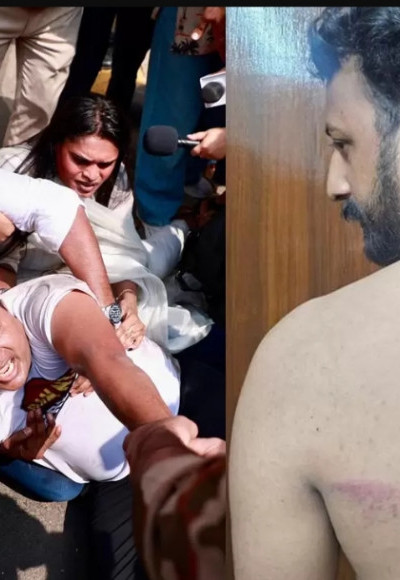 നീറ്റ് പരീക്ഷ ക്രമക്കേട് ഡൽഹിയിൽ യൂത്ത് കോൺഗ്രസ് പ്രതിഷേധം ഇരമ്പി ; ലാത്തിചാർജിൽ രാഹുൽ മാങ്കൂട്ടത്തിന് ഗുരതര പരിക്ക്.